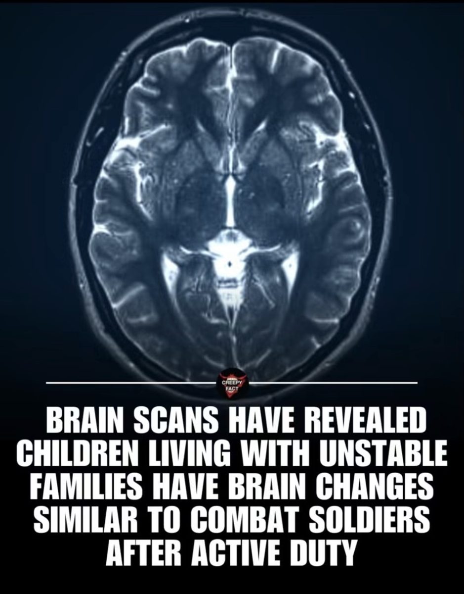 Screenshot of the viral post we checked, claiming: Brain scans have revealed children living with unstable families have brain changes similar to combat soldiers after active duty.